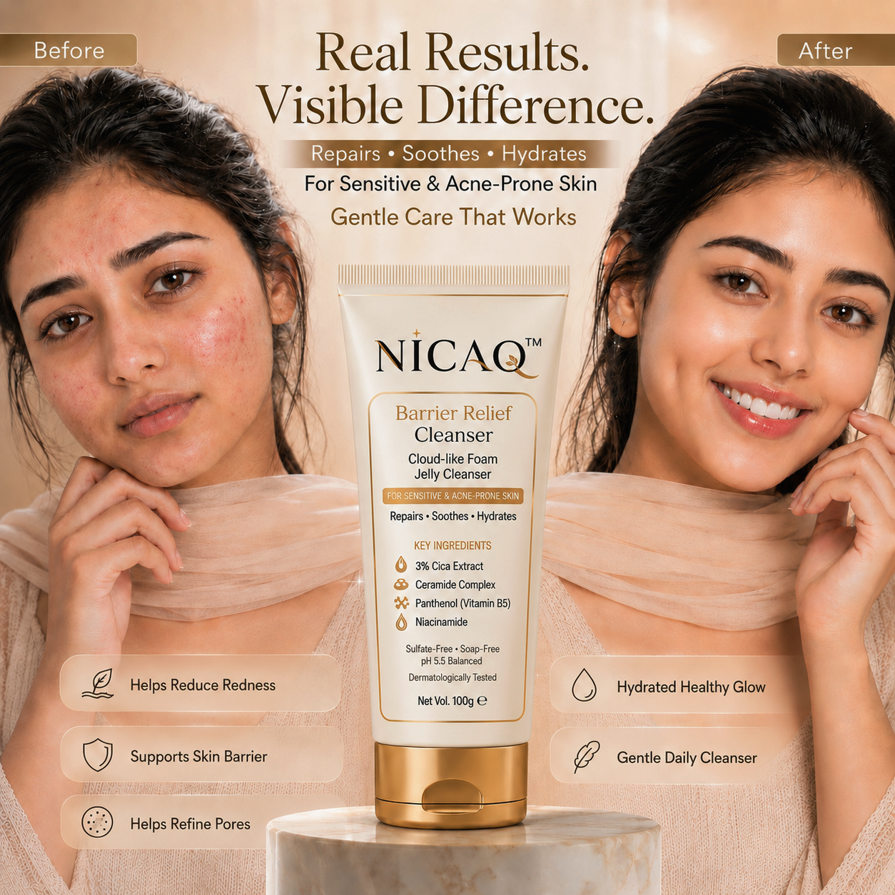 NICAQ Acne Control Face Wash – 3% Cica, Ceramide & Niacinamide – Gentle Barrier Repair Cleanser for Acne, Redness, Excess Oil & Sensitive Skin – Non Drying Daily Face Wash – 100g